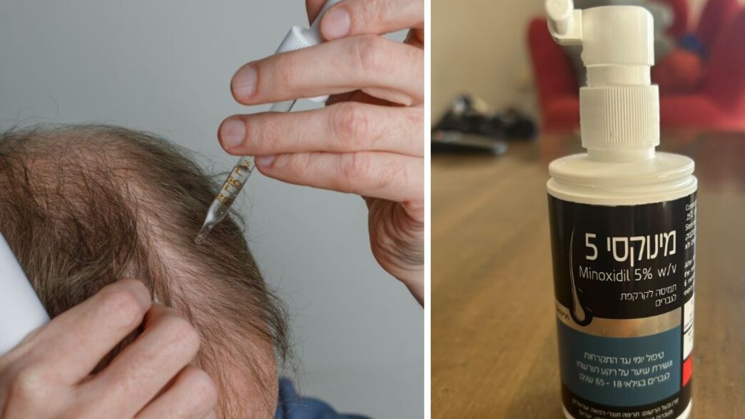 מינוקסי MINOXIDIL
