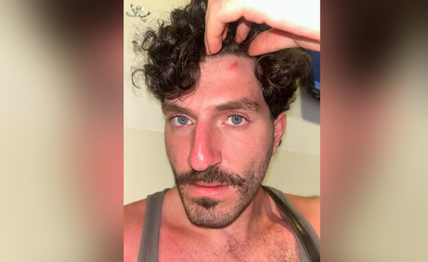 "לא תצא חי": סיוט בבריכת המלון המוכר בירושלים
