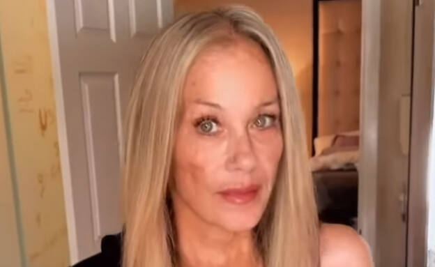 כריסטינה אפלגייט (צילום: Christina Applegate, Instagram)