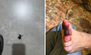 חיפושית זבל עקצה (צילום: עצמי)