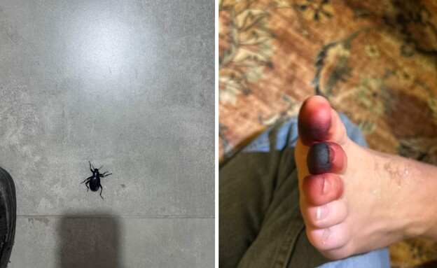 חיפושית זבל עקצה