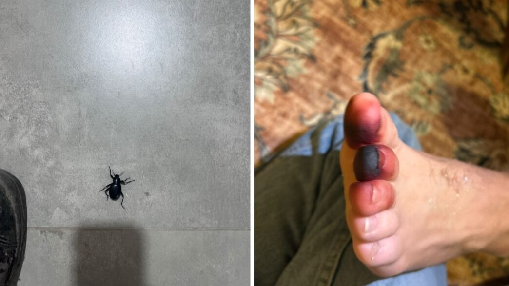 חיפושית זבל עקצה חיפושית זבל עקצה
