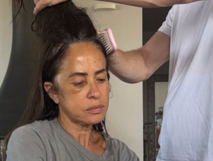 "ירד לי שליש מכמות השיער": עינת ארליך מספרת על רגעי השיקום