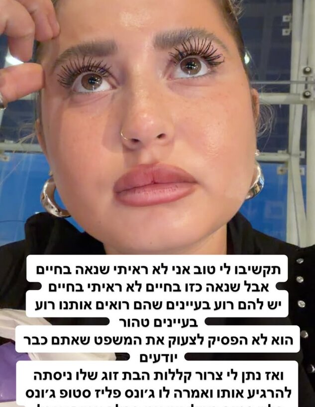 שלקה שלקה
