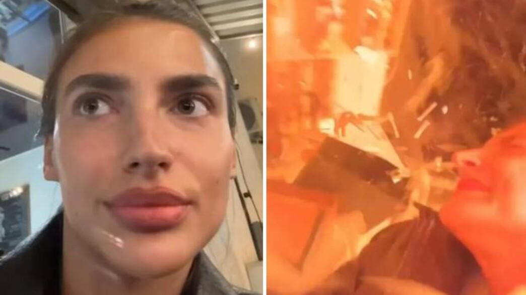 צילמה ולוג כשהטיל פגע צילמה ולוג כשהטיל פגע