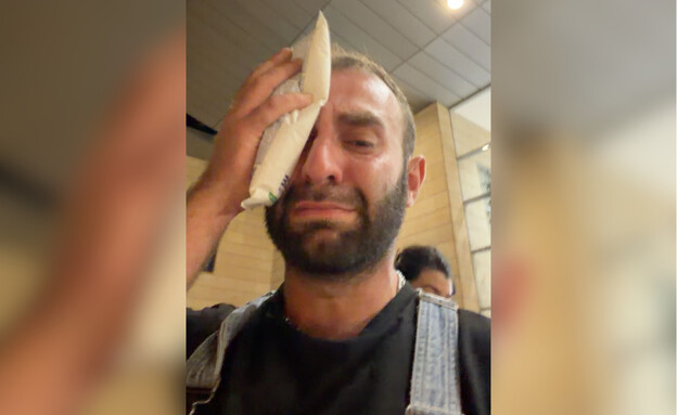 הותקף באלימות קשה: תיעוד מטריד מת"א