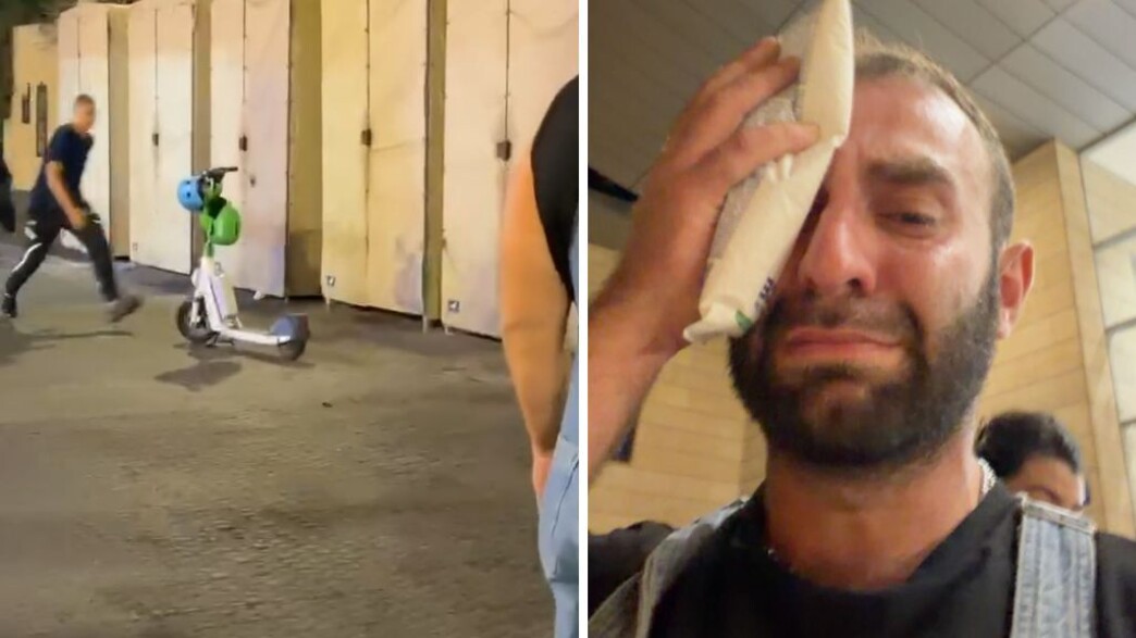 מעריץ של ליהי טולדנו הותקף אחרי ההופעה שלה