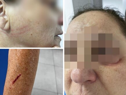 בת 60 מבת ים הותקפה: "צעירה הכתה אותי לעיני נכדי בן ה-11 אחרי שצפרתי לה"