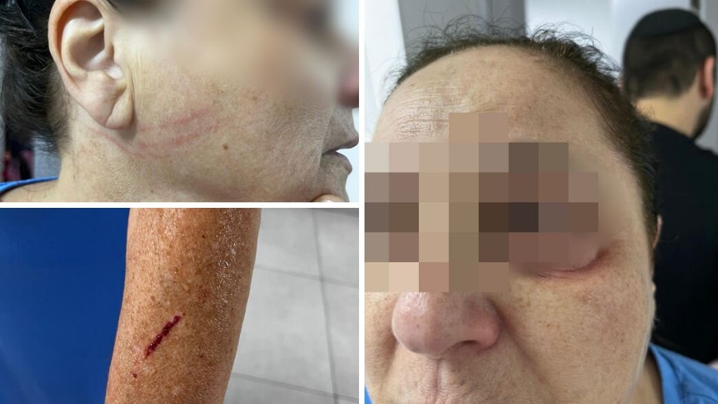קורבן התקיפה בבת ים קורבן התקיפה בבת ים
