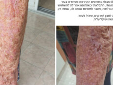 הפנייה הנרגשת