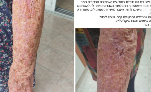 הפנייה הנרגשת
