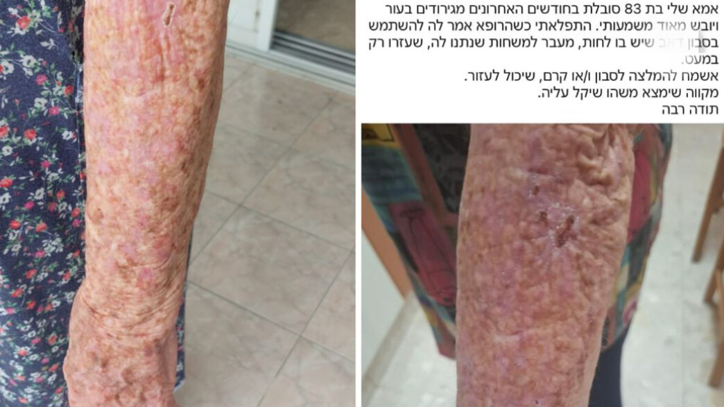 הפנייה הנרגשת הפנייה הנרגשת