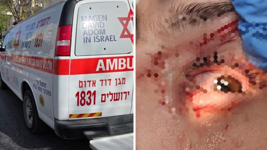 הילד שנפצע הילד שנפצע